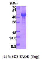Human OPTC / Opticin Protein (Recombinant His)