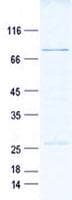 Human GALNT14 Protein (Recombinant GST, N-terminus + His, C-terminus)