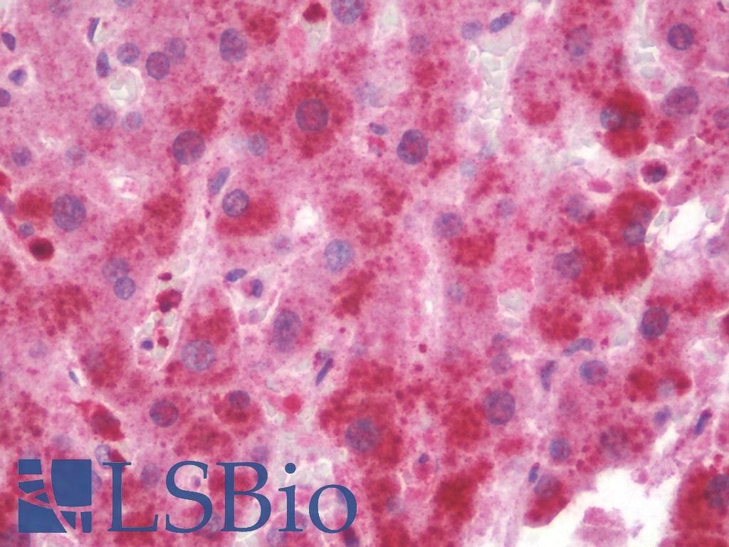 IHC-plus™ Polyclonal Rabbit anti-Human MECR Antibody (IHC, WB)