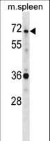 Polyclonal Rabbit anti-Human SH3BP2 Antibody (aa151-180, WB)
