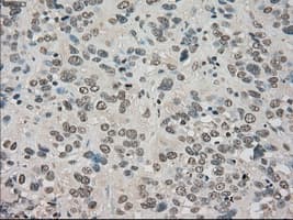 NTRK3 / TRKC Antibody (clone OTI2B8)