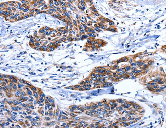 Polyclonal Rabbit anti-Human AQP8 / Aquaporin 8 Antibody (IHC)