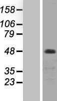 Human PRKCZ / PKC-Zeta Protein (Over-Expression Lysate Myc-DDK (Flag))
