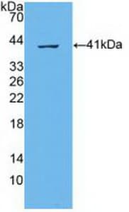 ABCA4 Antibody (aa1398-1727)