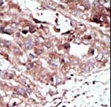PHKG2 Antibody (aa41-71)