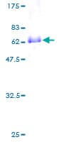 Human DLX2 Protein (Recombinant GST)