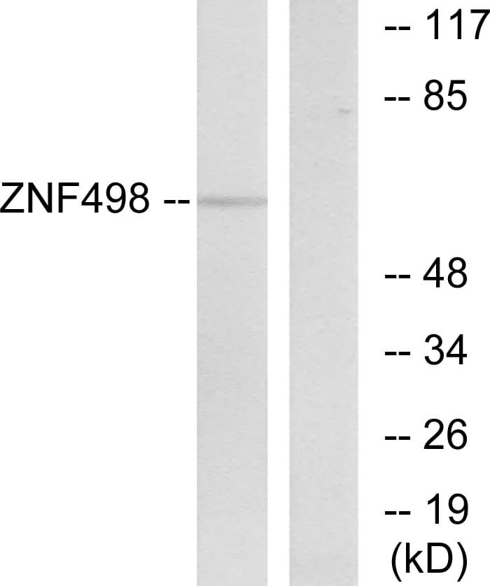 Polyclonal Rabbit anti-Human ZNF498 Antibody (aa331-380, WB)