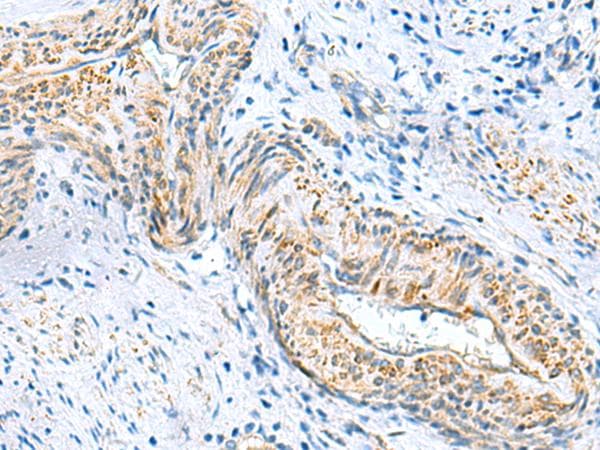 MLC3F / MYL1 Antibody