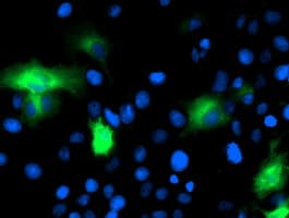 CAPN9 / Calpain 9 Antibody (clone OTI2G1)