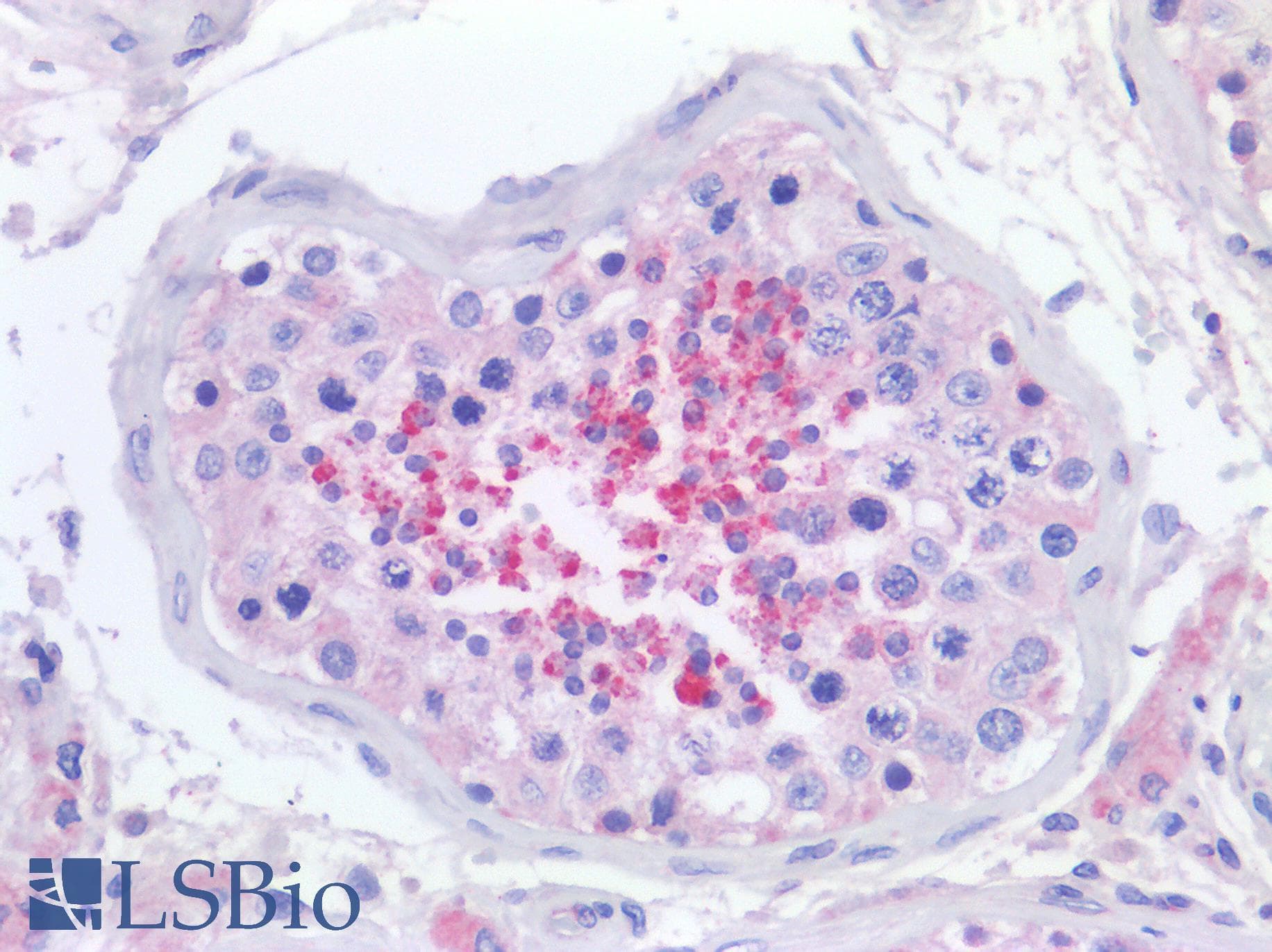 IHC-plus™ SYNJ2BP / OMP25 Antibody