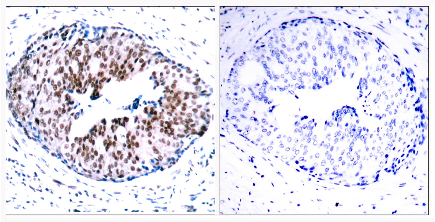 STAT5A Antibody (phospho-Ser780)