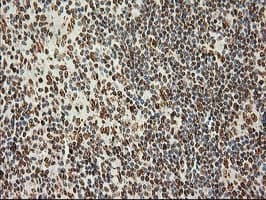 LOX / Lysyl Oxidase Antibody (clone OTI9G2)