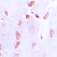 Polyclonal Rabbit anti-Human BCL2 / Bcl-2 Antibody (phospho-Thr69, IHC, WB)