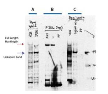 IHC-plus™ HTT / Huntingtin Antibody (phospho-Ser421)