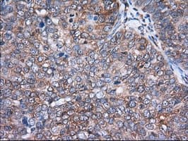 ACAT2 Antibody (clone OTI1B7)