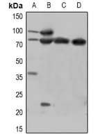 Polyclonal Rabbit anti-Human CTNNB1 / Beta Catenin Antibody (WB)