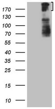 Monoclonal Mouse anti-Human BCOR Antibody (clone OTI4F6, aa384-668, WB)