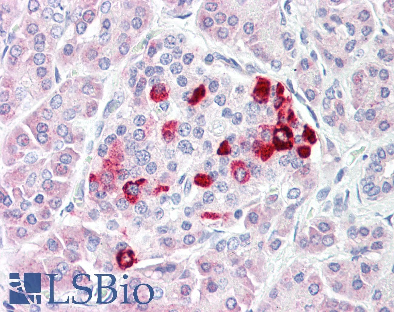 IHC-plus™ IGF1R / IGF1 Receptor Antibody (aa1126-1175)