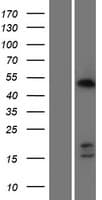CDCA7 Protein (Over-Expression Lysate Myc-DDK (Flag))