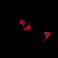 TUSC5 Antibody (N-Terminus)