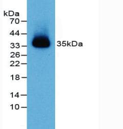 PVRL2 / CD112 Antibody (aa83-291)