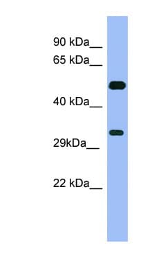 MAGEB1 Antibody (C-Terminus)