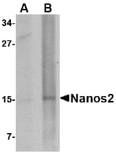 NANOS2 / NOS2 Antibody