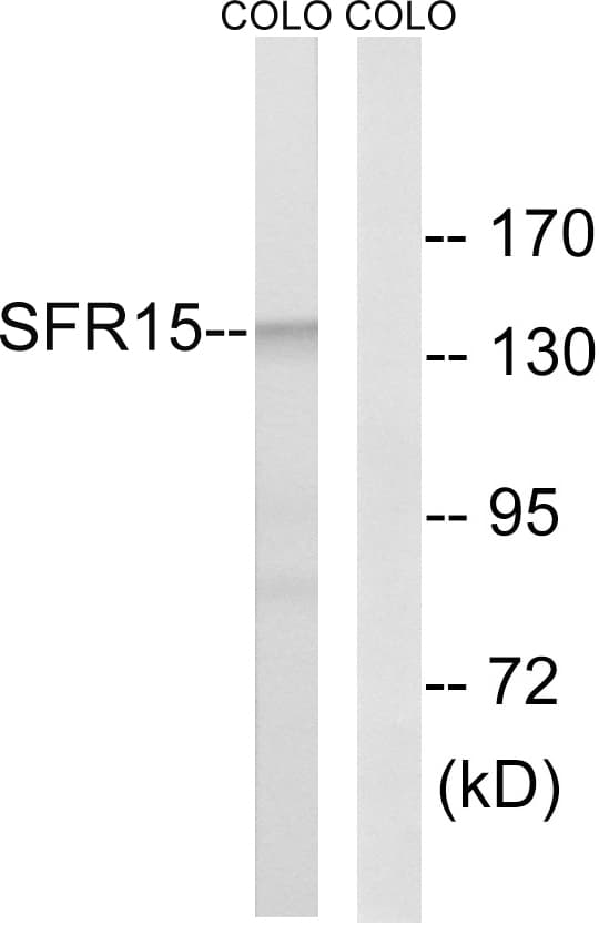 IHC-plus™ SCAF4 Antibody (aa601-650)