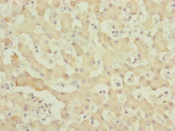 Polyclonal Rabbit anti-Human MYO5B / Myosin VB Antibody (IHC, WB)