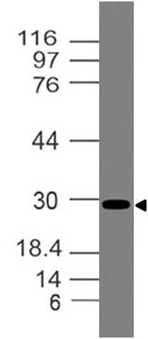 HAVCR2 / TIM-3 Antibody