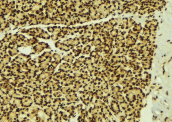 STAT5B Antibody