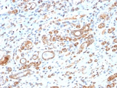 HSPD1 / HSP60 Antibody (clone HSPD1/2206R)