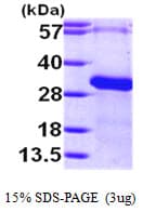 Human RGS19 Protein (Recombinant His)