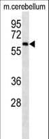Monoclonal Mouse anti-Human CAMKK2 Antibody (WB)