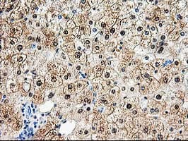 ACY1 / Aminoacylase 1 Antibody (clone OTI1B12)