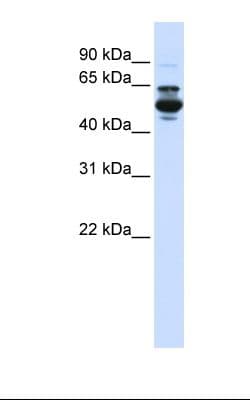 CYP3A43 Antibody (aa398-447)