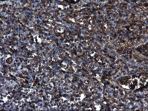 FGG / Fibrinogen Gamma Antibody (clone OTI5D7)