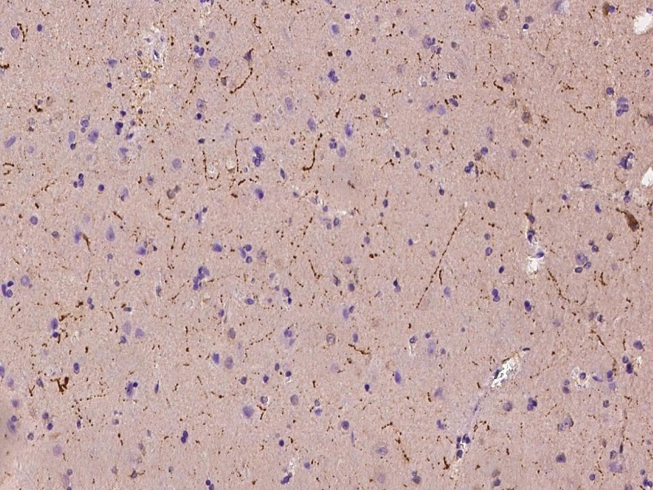 Neuropeptide Y / NPY Antibody