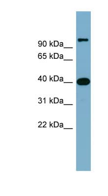 CCNDBP1 / GCIP Antibody (aa179-228)