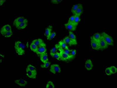 MOGAT1 / MGAT1 Antibody