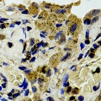 Polyclonal Rabbit anti-Human PLCG1 Antibody (Internal, IHC, WB)