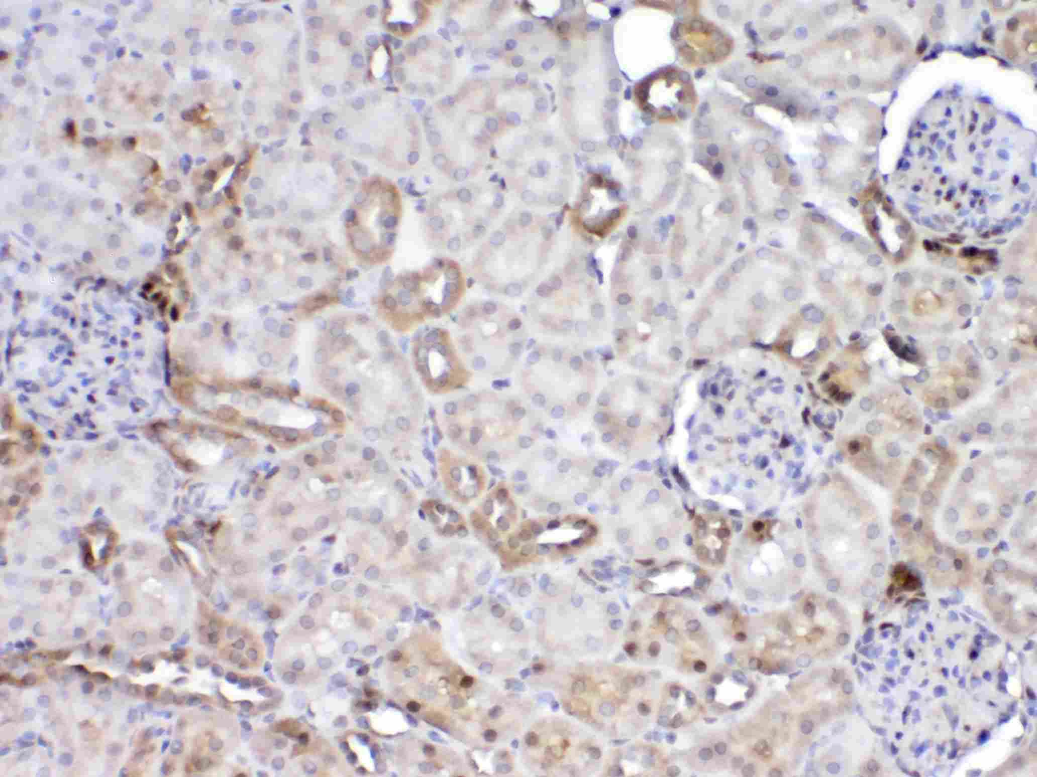 Polyclonal Rabbit anti-Mouse GSTP1 / GST Pi Antibody (IHC, WB)