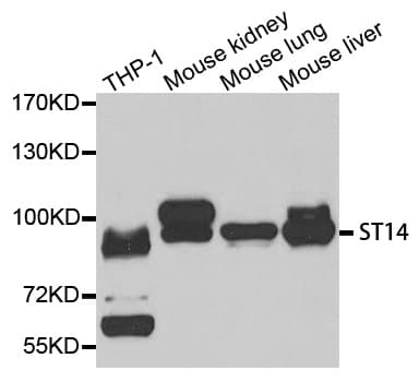 ST14 / Matriptase Antibody (aa566-855)