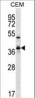WDR25 Antibody (aa444-473)
