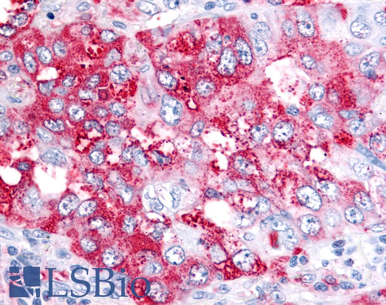 IHC-plus™ BEST4 Antibody (Internal)