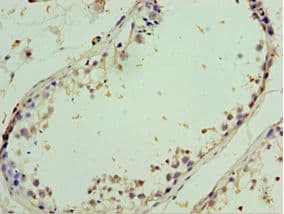 Polyclonal Rabbit anti-Human AIMP2 Antibody (aa141-320, IHC, WB)