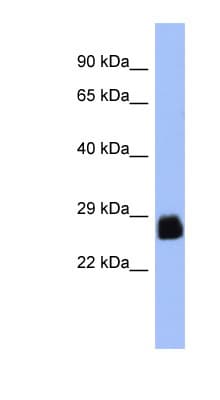 PDX1 Antibody (N-Terminus)