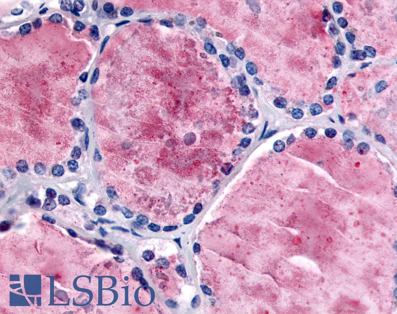 IHC-plus™ Polyclonal Rabbit anti-Human PDE8B Antibody (Internal, IHC)