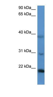 IMMP2L Antibody (aa48-97)