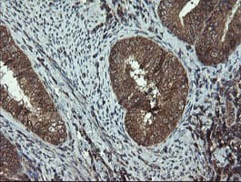 DOK7 Antibody (clone OTI1A9)